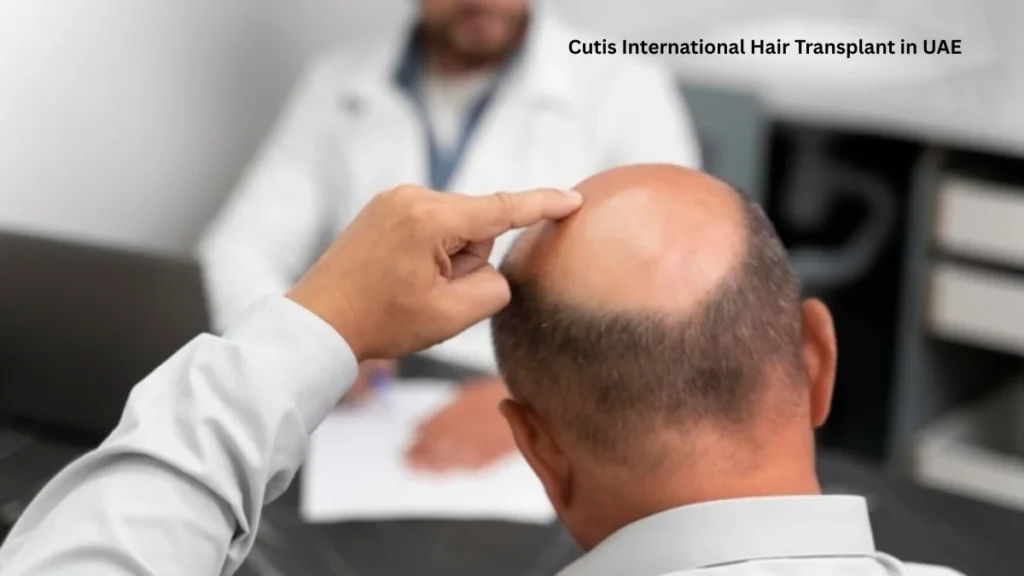 Cutis International Hair Transplant in UAE