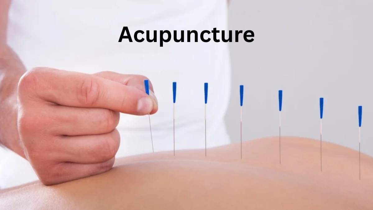 Acupuncture