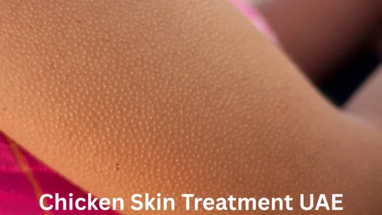 Chicken Skin Treatment UAE