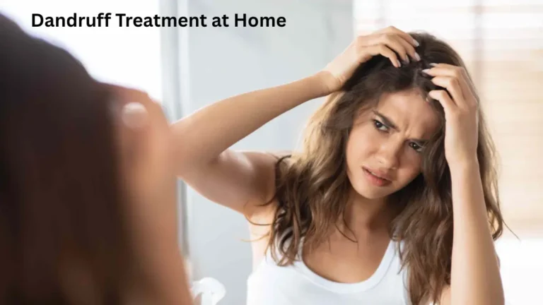 Dandruff Treatment at Home