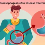 Gastroesophageal reflux disease treatments