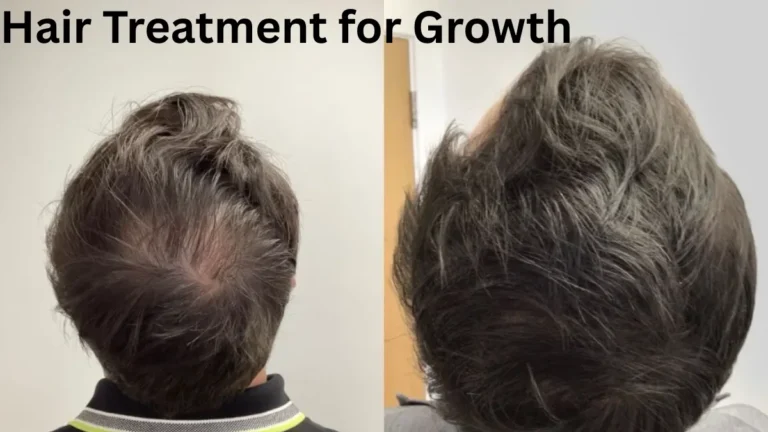 Hair Treatment for Growth