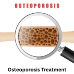 Osteoporosis Treatment