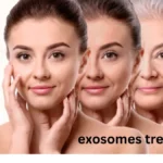 exosomes treatment