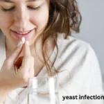 yeast infection treatment